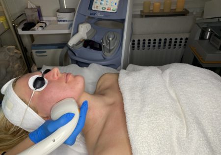 Laser Treatments